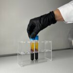 glycolytic trap - laboratory blood sample analysis illustrating post-viral metabolic testing